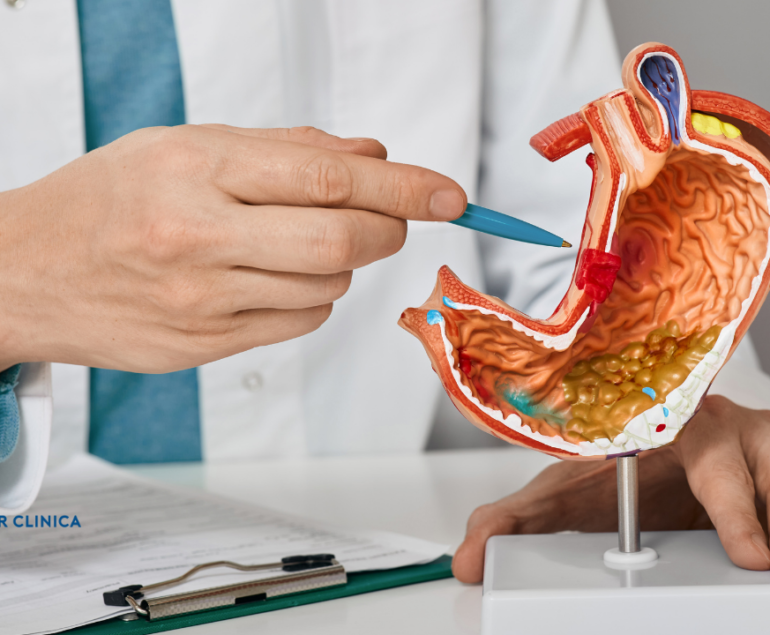 Gastrik Bypass Mı Tüp Mide Mi? Hangi Ameliyat Size Uygun?