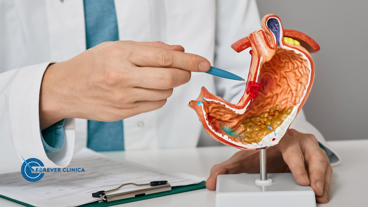 Gastrik Bypass Mı Tüp Mide Mi? Hangi Ameliyat Size Uygun?