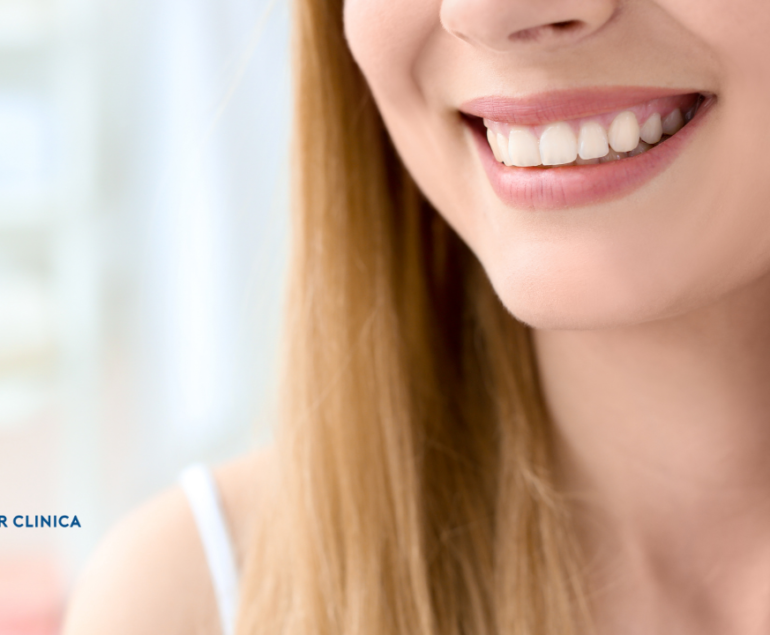 Transforming Smiles: The Journey to Your Hollywood Smile