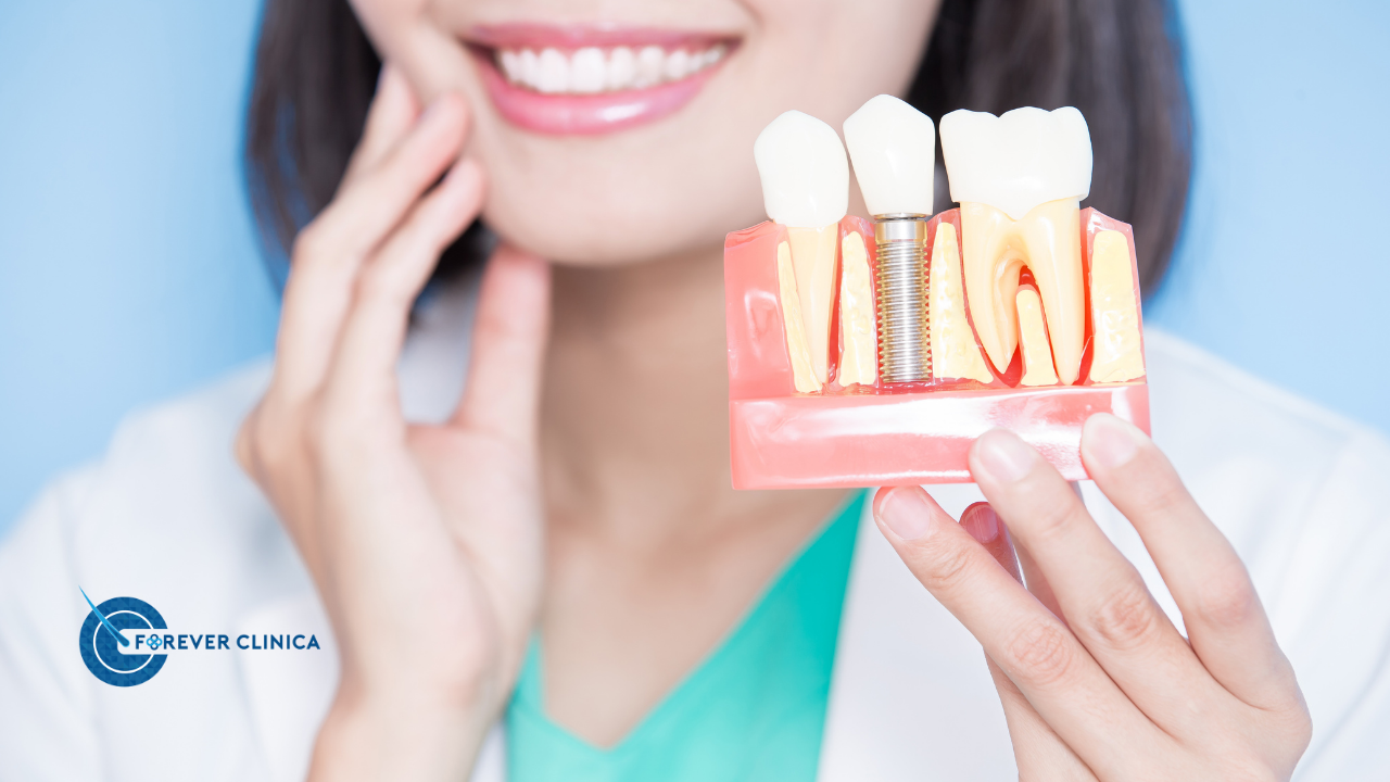 The Comprehensive Guide to Dental Implants
