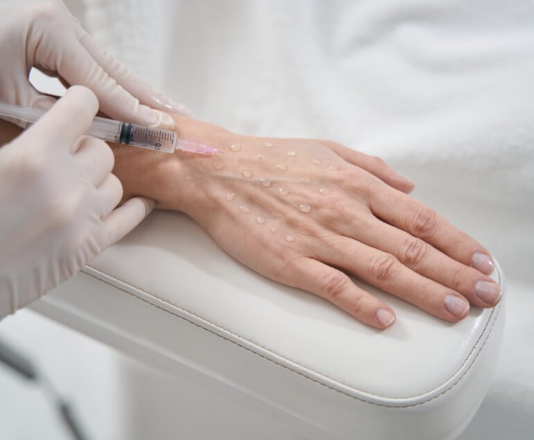 Botox for Hand Sweating