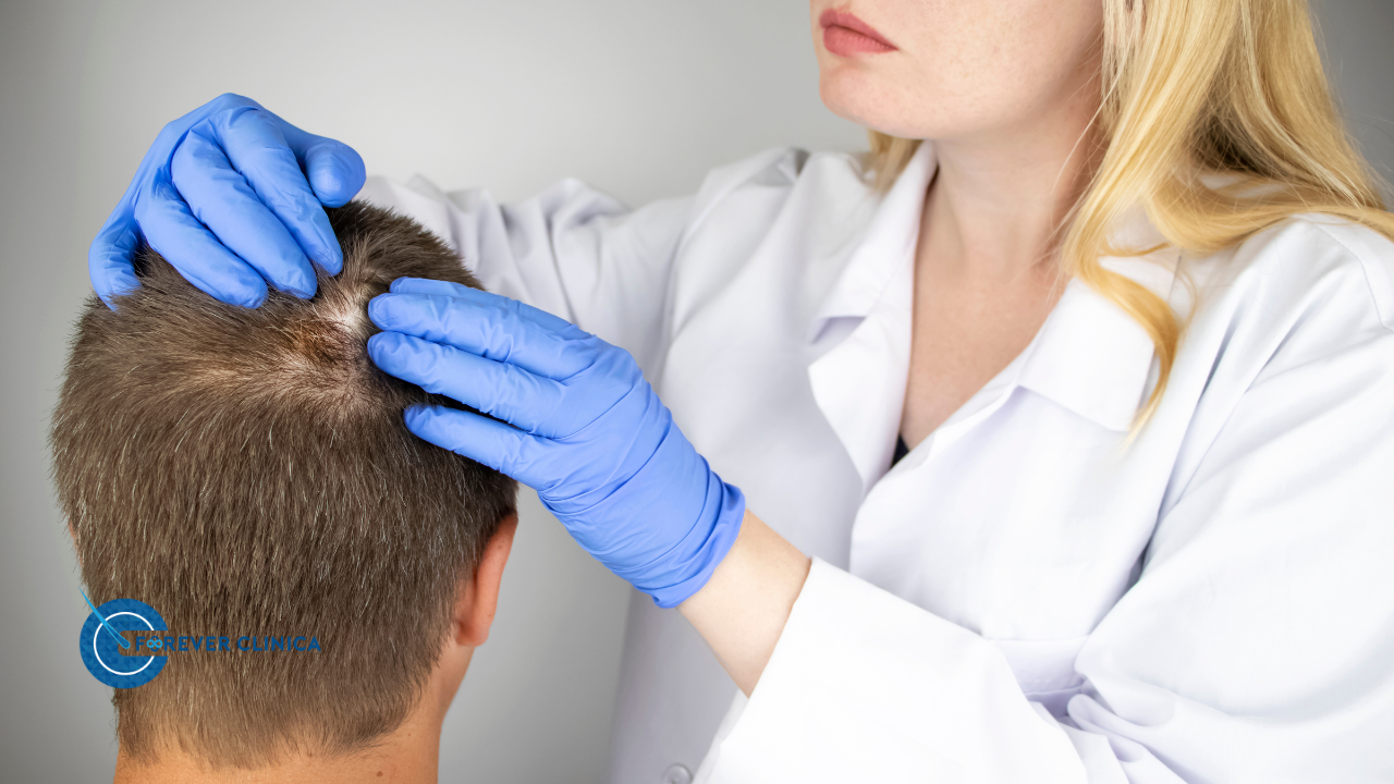 Saçkıran (Alopesi) Nedir?