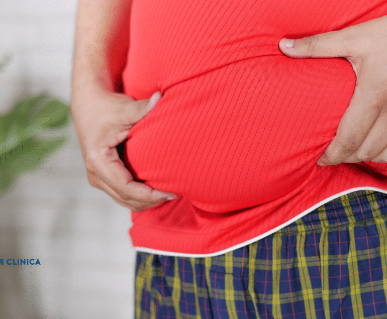 The Harms of Obesity