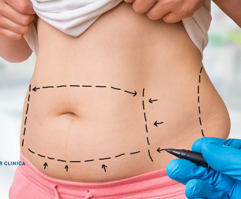 Gastric Reduction Methods