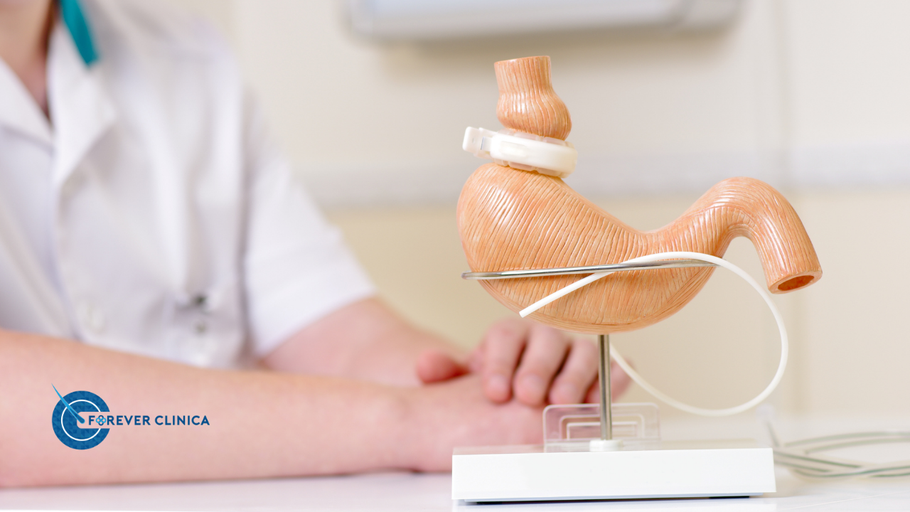 Ce este chirurgia bariatrică