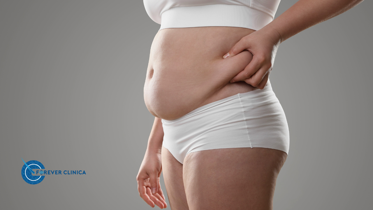 Chirurgie Obezitate | Chirurgie Bariatrică | Tratament Obezitate