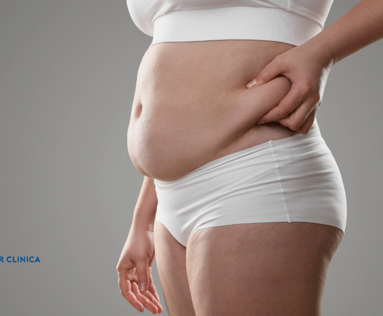 Obezite Ameliyatı | Obezite Cerrahisi | Obezite Tedavisi