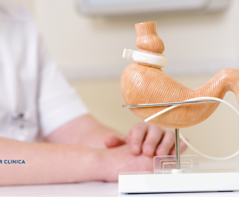 What is Bariatric Surgery