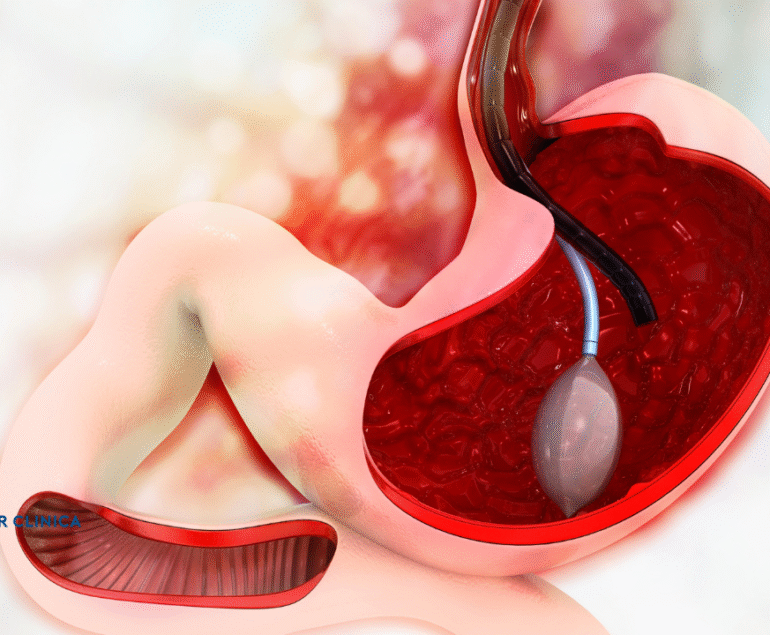 Gastrik By-pass Ameliyatında Kullanılan Cerrahi Yöntemler Nelerdir?