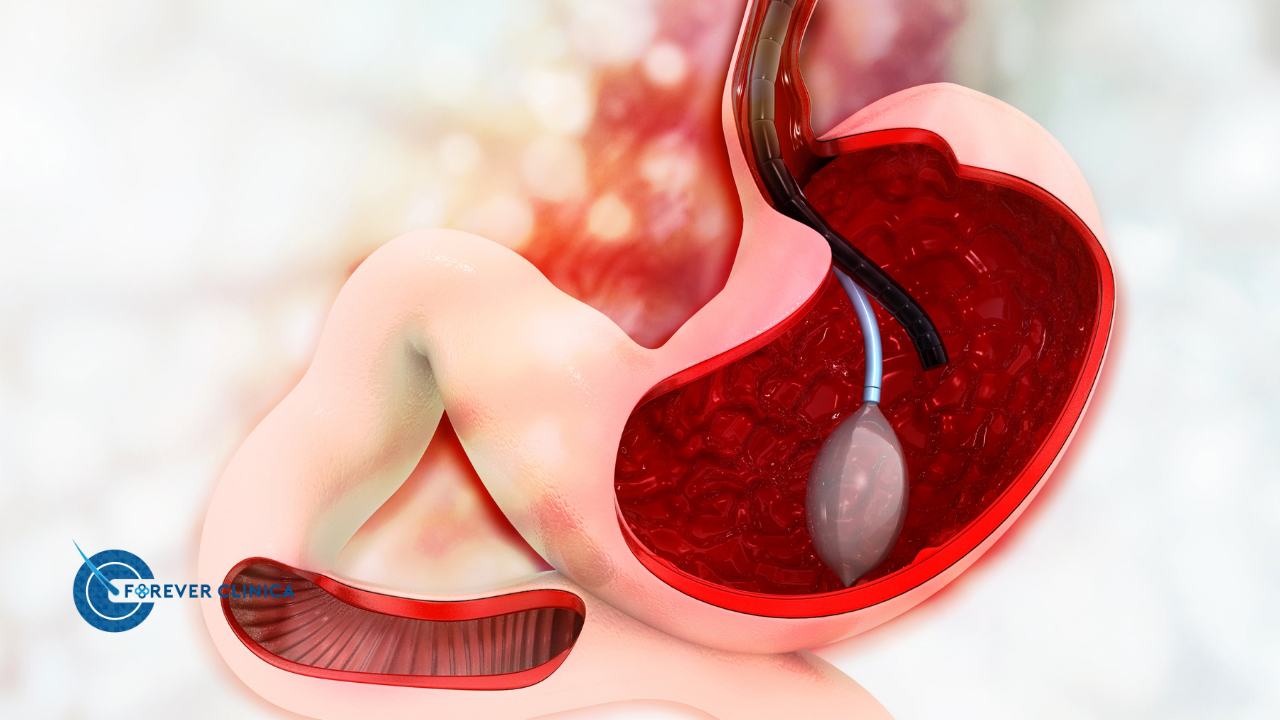 Gastrik By-pass Ameliyatında Kullanılan Cerrahi Yöntemler Nelerdir?