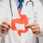 What Should Be Done After Sleeve Gastrectomy