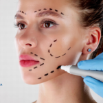 Ce este o Operație de Lifting Facial? Operație de Lifting Facial. Operație de Lifting Facial
