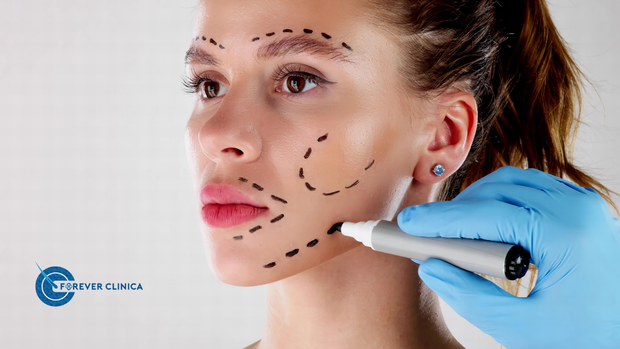 What is a Facelift Operation? Facelift Surgery. Facelift Surgery
