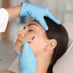 Что такое наполнитель для висков? Как это делается?