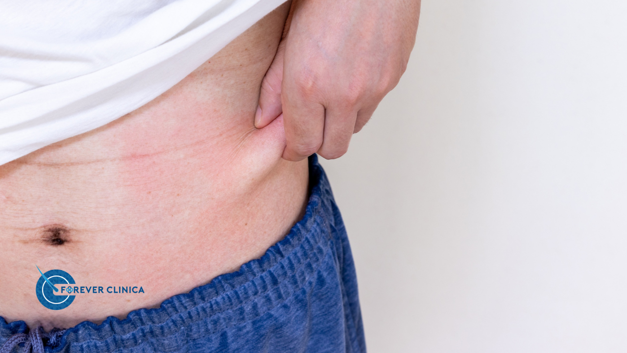 Skin Sagging Operation