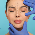 What is a Facelift Surgery?