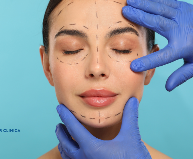 What is a Facelift Surgery?