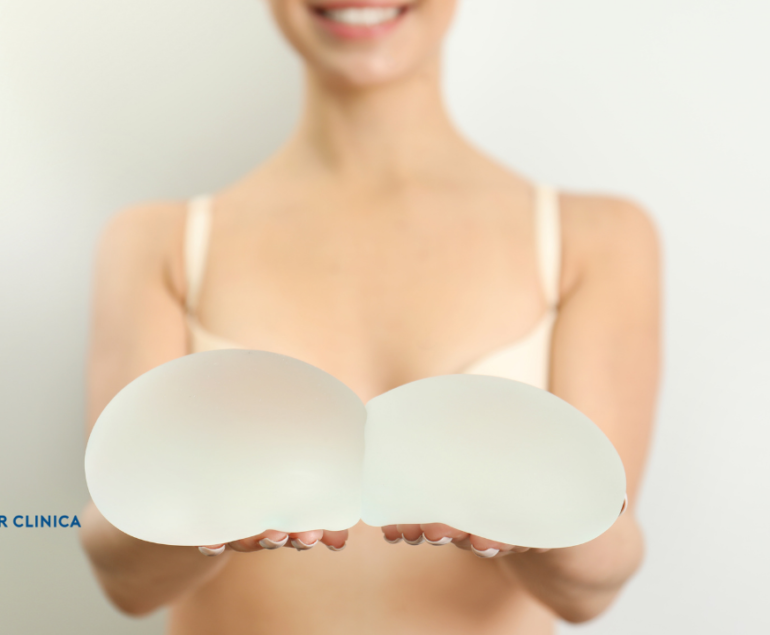 What is a Mentor Breast Implant? Mentor Breast Implant Types