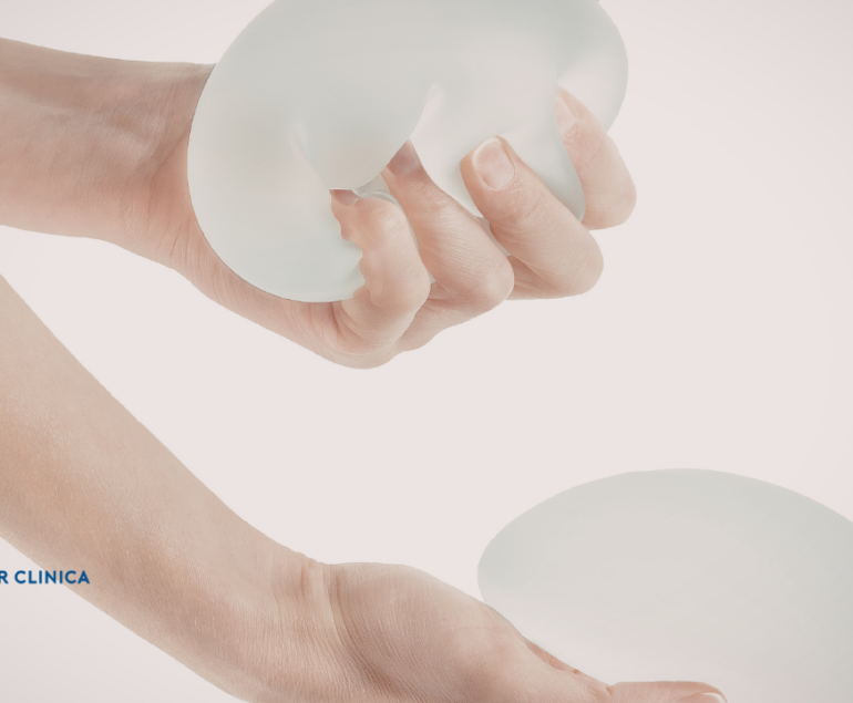 In breast augmentation, 'teardrop' or 'round' implant